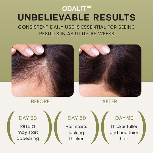 🔥LAST DAY SALE-60% OFF -ODALIT™ Wonder Growth Oil
