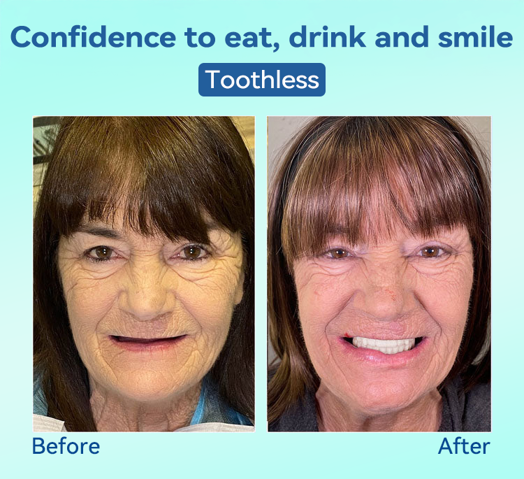 DIYSTAR™ 🍀𝐏𝐫𝐞𝐦𝐢𝐮𝐦 𝐃𝐞𝐧𝐭𝐮𝐫𝐞(🦷𝐋𝐢𝐦𝐢𝐭𝐞𝐝 𝐭𝐢𝐦𝐞 𝐝𝐢𝐬𝐜𝐨𝐮𝐧𝐭 𝐋𝐚𝐬𝐭 𝟑𝟎 𝐦𝐢𝐧𝐮𝐭𝐞𝐬🦷)