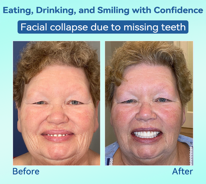 DIYSTAR™ 🍀𝐏𝐫𝐞𝐦𝐢𝐮𝐦 𝐃𝐞𝐧𝐭𝐮𝐫𝐞(🦷𝐋𝐢𝐦𝐢𝐭𝐞𝐝 𝐭𝐢𝐦𝐞 𝐝𝐢𝐬𝐜𝐨𝐮𝐧𝐭 𝐋𝐚𝐬𝐭 𝟑𝟎 𝐦𝐢𝐧𝐮𝐭𝐞𝐬🦷)