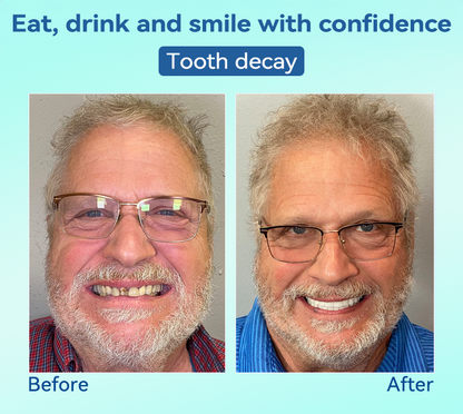 DIYSTAR™ 🍀𝐏𝐫𝐞𝐦𝐢𝐮𝐦 𝐃𝐞𝐧𝐭𝐮𝐫𝐞(🦷𝐋𝐢𝐦𝐢𝐭𝐞𝐝 𝐭𝐢𝐦𝐞 𝐝𝐢𝐬𝐜𝐨𝐮𝐧𝐭 𝐋𝐚𝐬𝐭 𝟑𝟎 𝐦𝐢𝐧𝐮𝐭𝐞𝐬🦷)