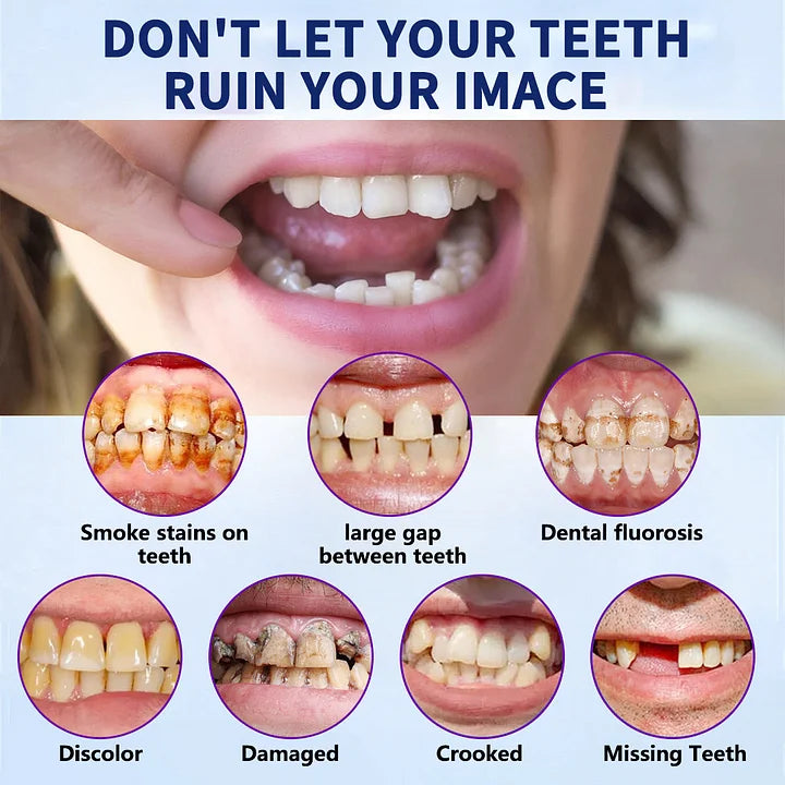 Advanced Customized Full Denture Set🦷
