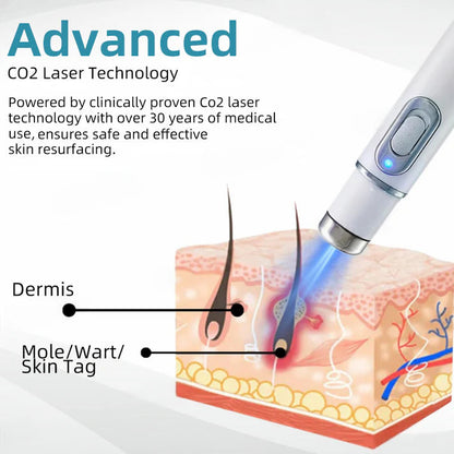 Aprolo™ Non-invasive Mole and Wart Removal Laser Pen
