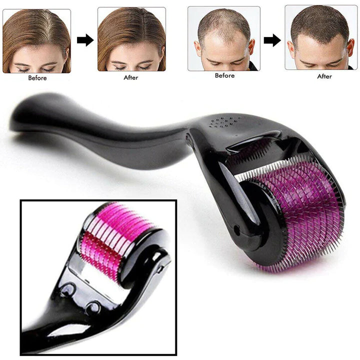 Derma Roller For Hair Growth & Scalp Care