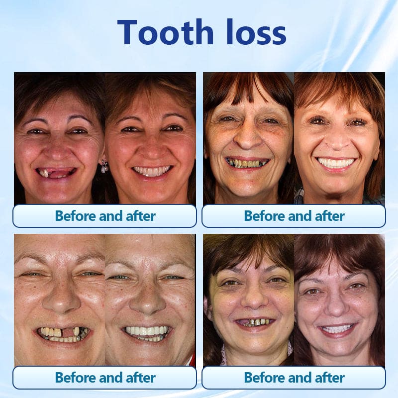 Silicone Denture Set 🦷