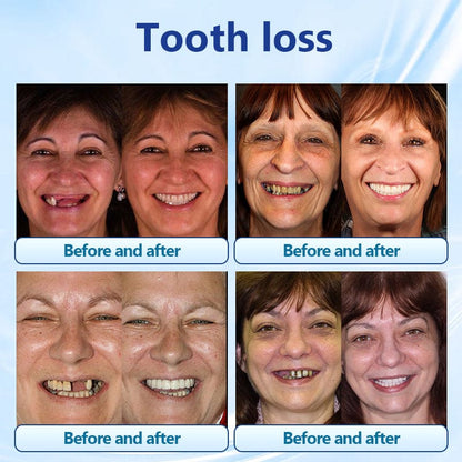 Silicone Denture Set 🦷