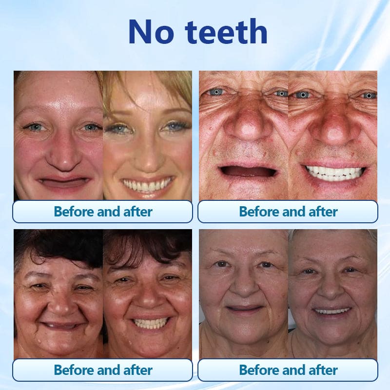 Silicone Denture Set 🦷