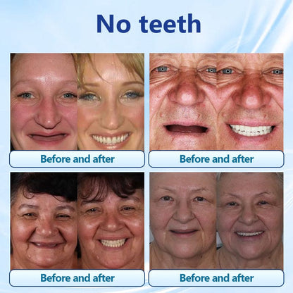 Silicone Denture Set 🦷