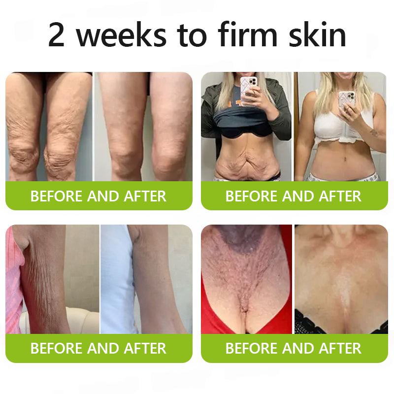 Botox & Retinol Shot | Eraser for deep wrinkles