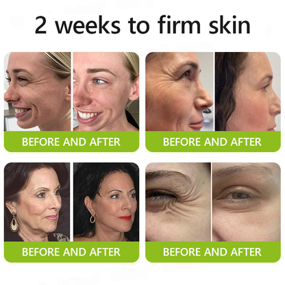 Botox & Retinol Shot | Eraser for deep wrinkles