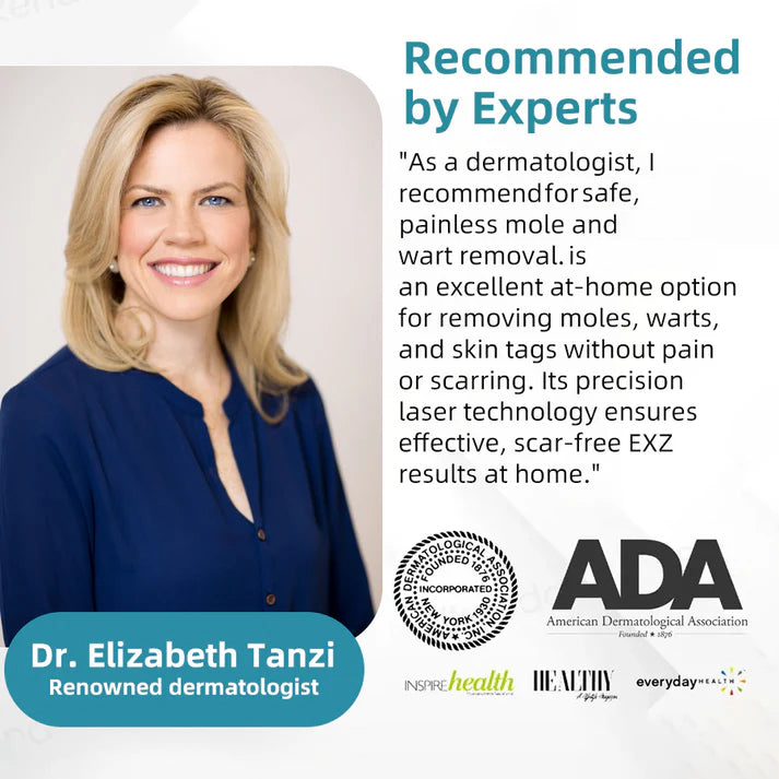 Aprolo™ Non-invasive Mole and Wart Removal Laser Pen