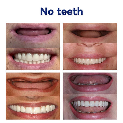 Advanced Customized Full Denture Set🦷