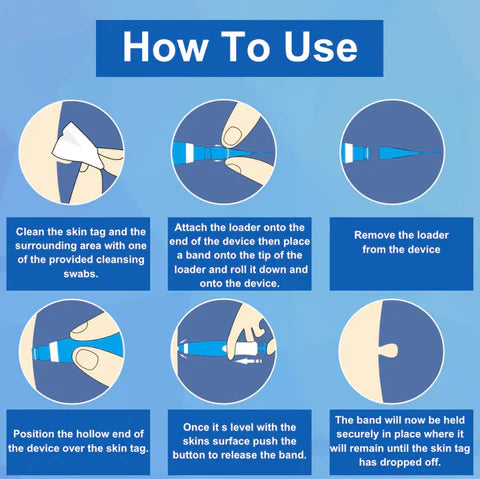 AutoSkin Tag Remover Kit - No More Skin Tags