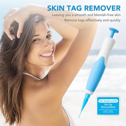 AutoSkin Tag Remover Kit - No More Skin Tags