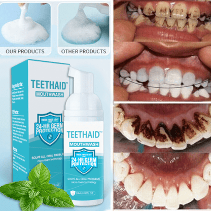 Teethaid™ Pure Herbal Teeth Whitening & Mouth Repair Mousse