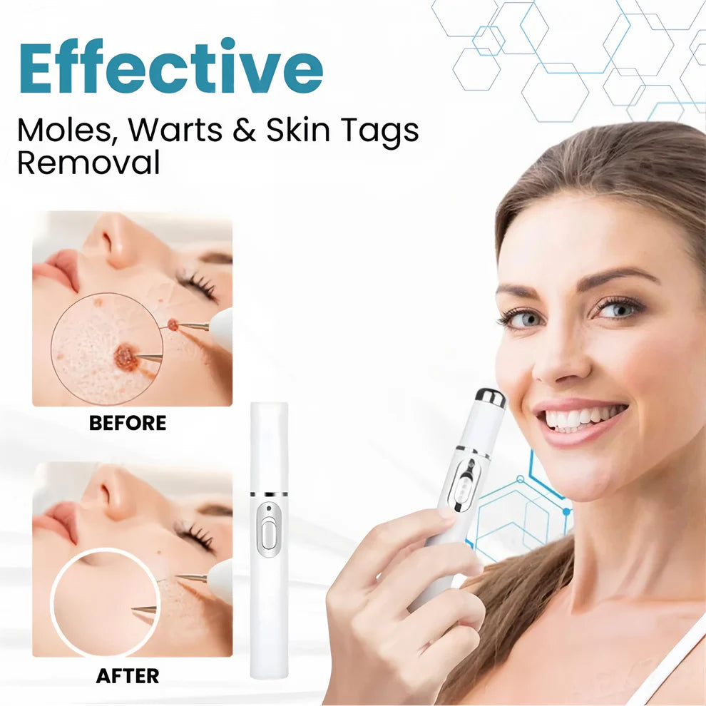 Aprolo™ Non-invasive Mole and Wart Removal Laser Pen