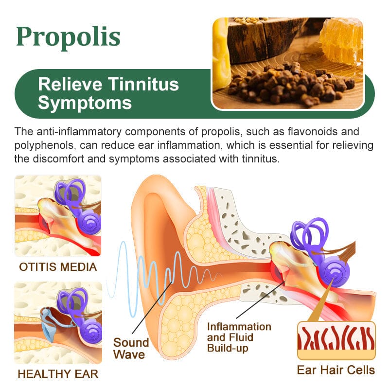 GFOUK™ Bee Propolis Tinnitus Soothing Spray