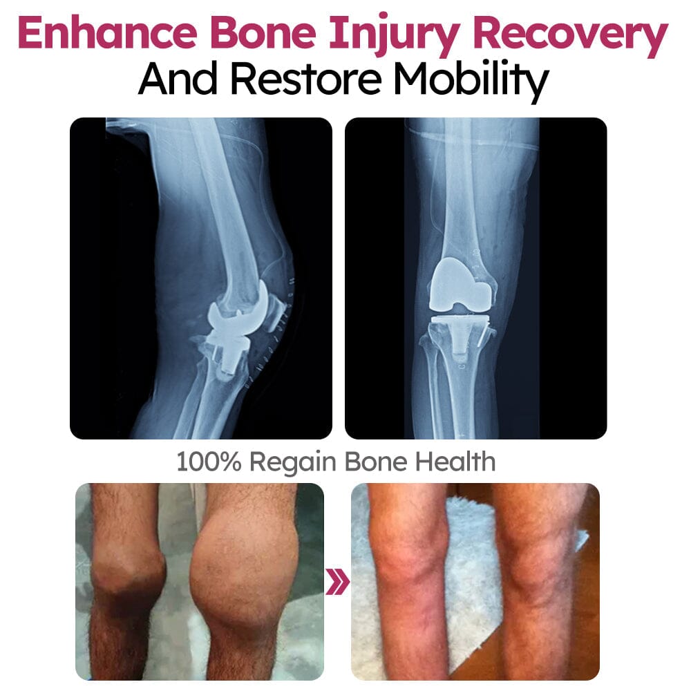 GFOUK™ Perfectx Joint and Bone Recovery Cream