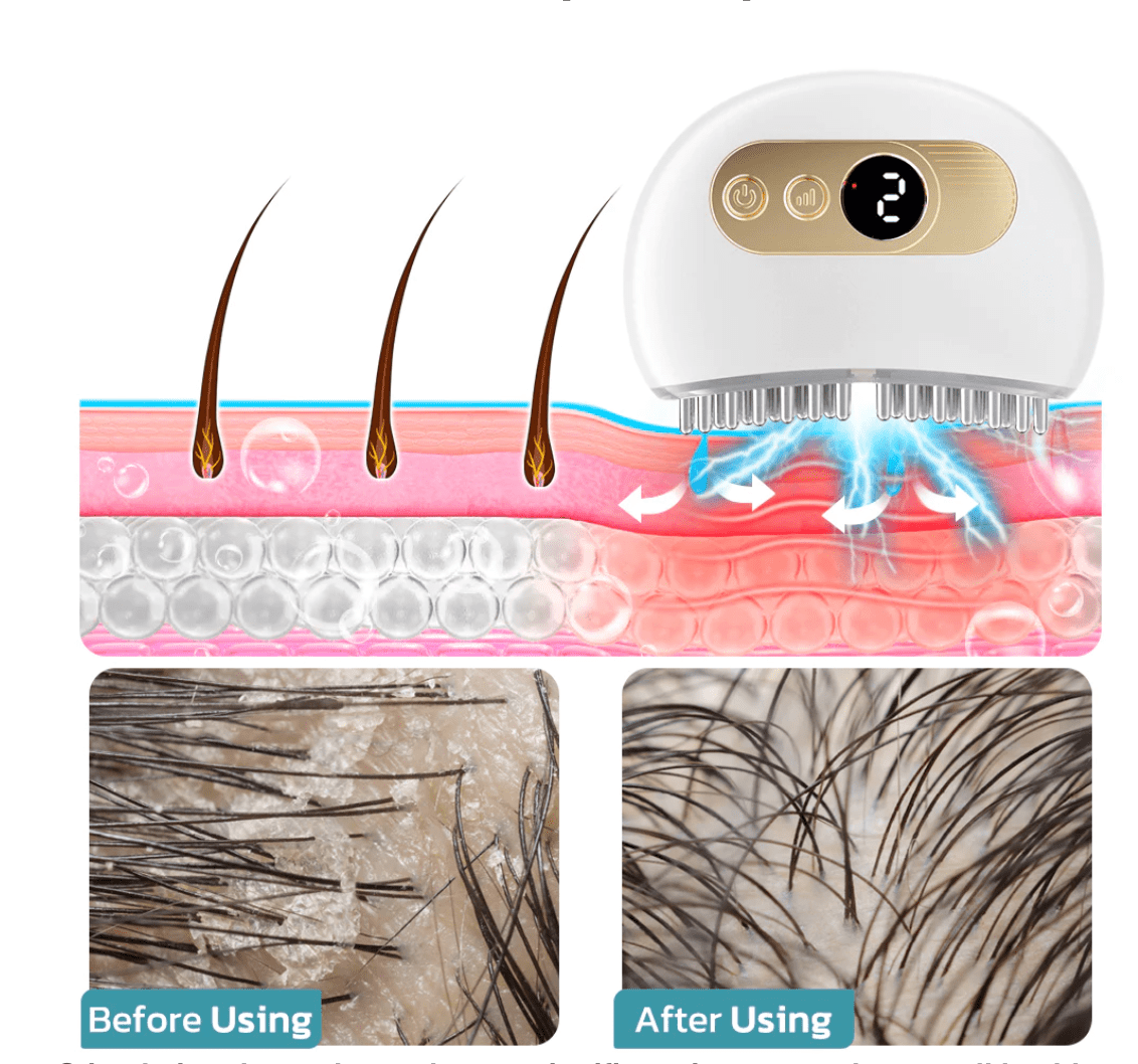 GFOUK™ EMS Lifting Facial And Nourishing Scalp Acupoint Massage Device