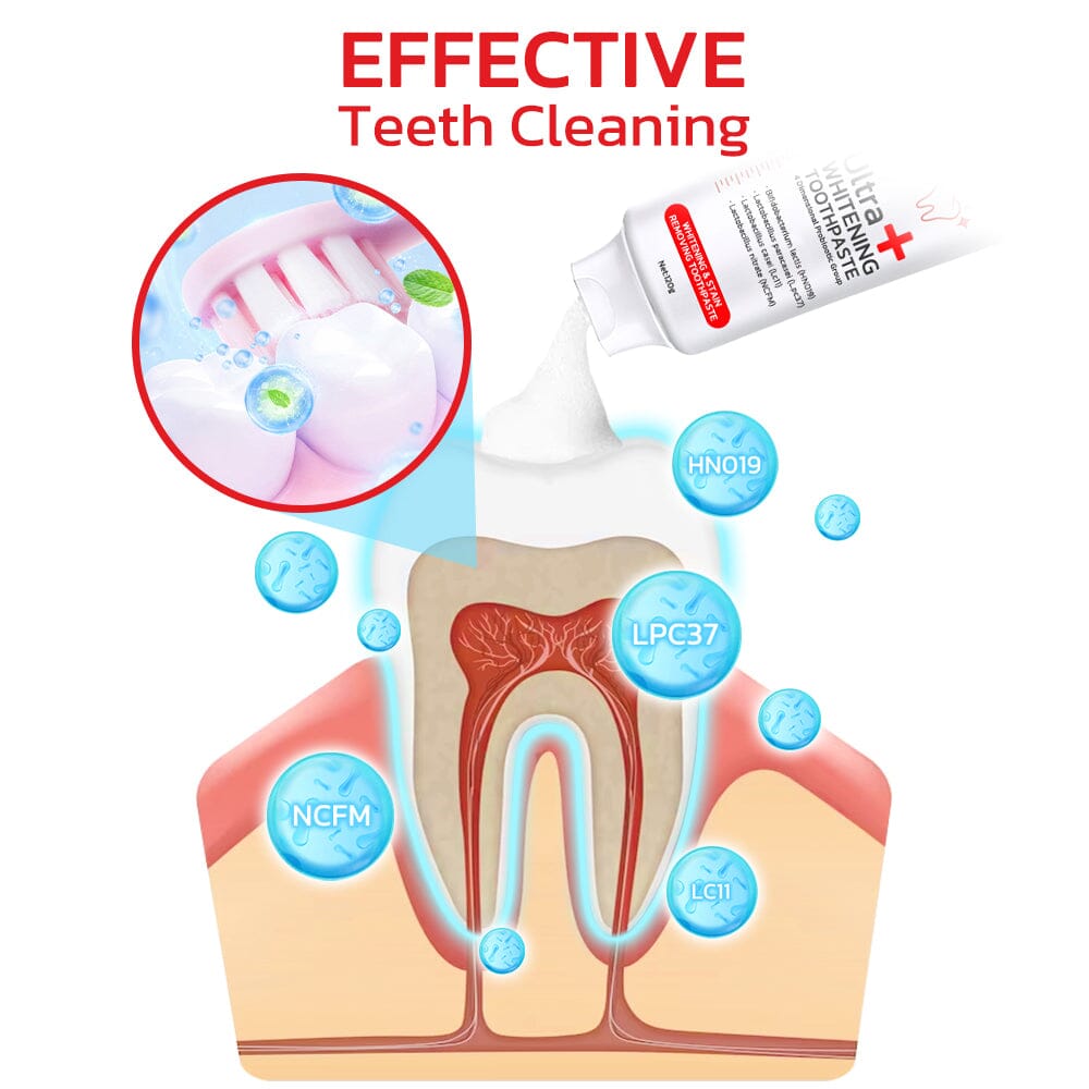 GFOUK™️ SP4 Probiotic Whitening Toothpaste