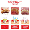 GFOUK™️ SP4 Probiotic Whitening Toothpaste