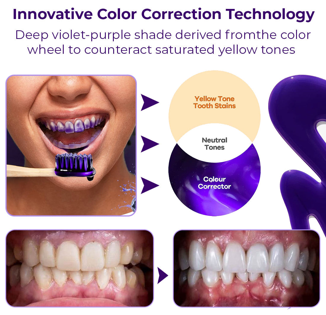 flysmus™ SmileBright White Refining Serum